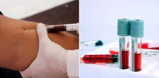 Understanding a blood test, we explain all the parameters