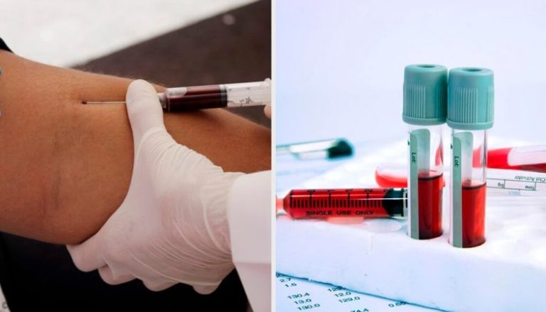 Understanding a blood test, we explain all the parameters