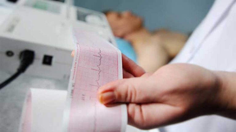 Everything you need to know about taking electrocardiogram