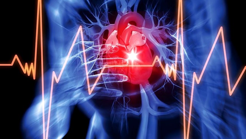 electrocardiogram