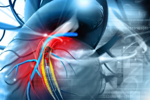 electrocardiogram