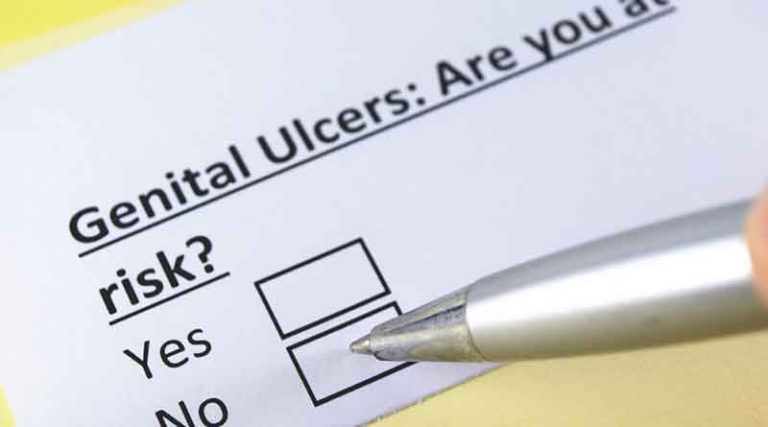 What causes genital ulcers? What is your treatment?