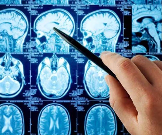What are the first symptoms of brain cancer? What are the first symptoms of brain cancer?
