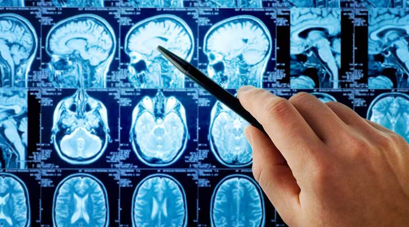 What are the first symptoms of brain cancer?