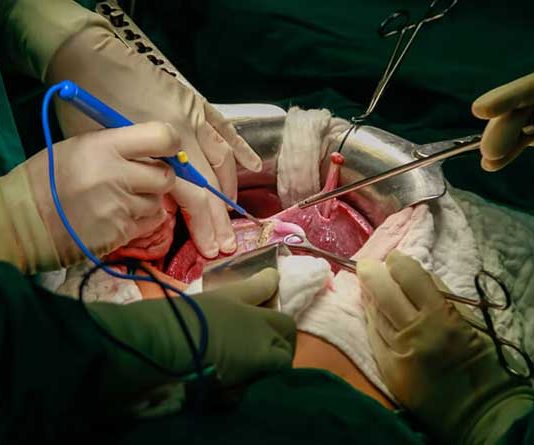 Liver transplant, What is the liver and how it works? Liver transplant, What is the liver is and how it works?